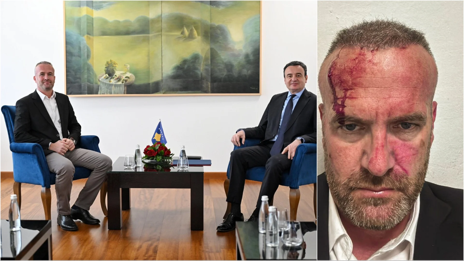 Dhunohet kreu i degës së LVV-së në Skënderaj, akuzon kryetarin e komunës, Vetëvendosja publikon foton